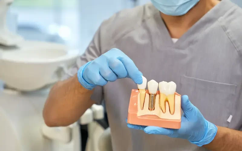 Dental Implants in Turkey Cost, Benefits, and Everything You Need to Know