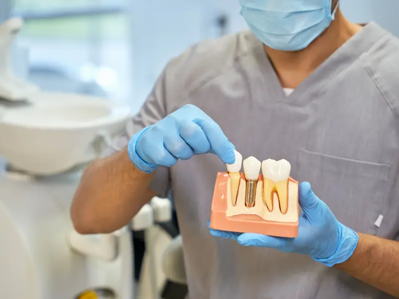 Dental Implants in Turkey Cost, Benefits, and Everything You Need to Know