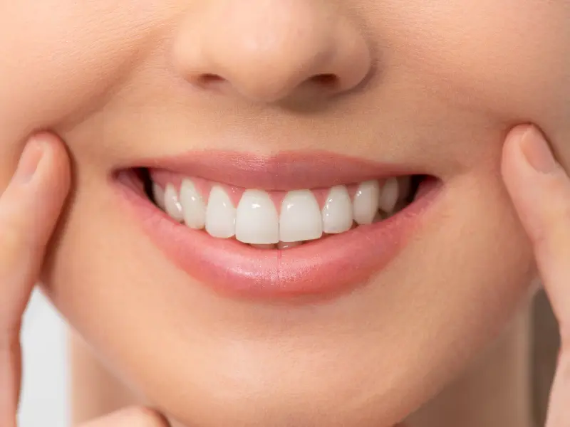 Hollywood Smile Istanbul Price: Perfect Smile at a Good Cost